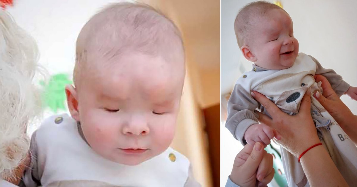 4 44.png?resize=412,275 - A Baby Born Without Eyes Finds A New Loving Home
