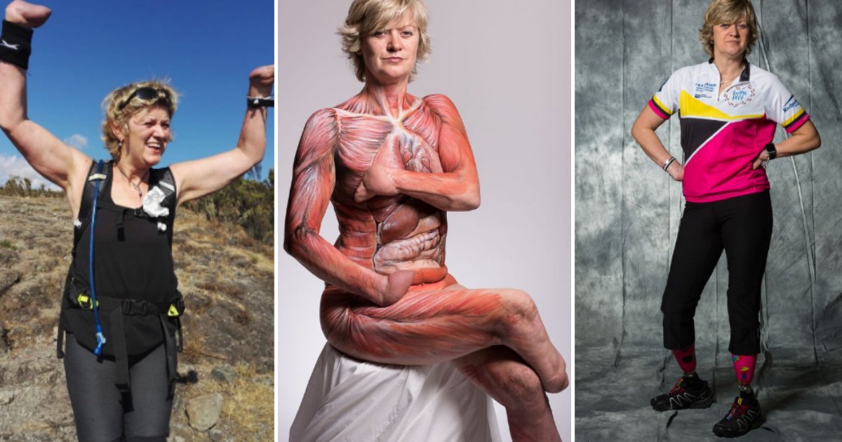 51.png?resize=412,275 - Mum Loses Four Limbs Due to Sepsis