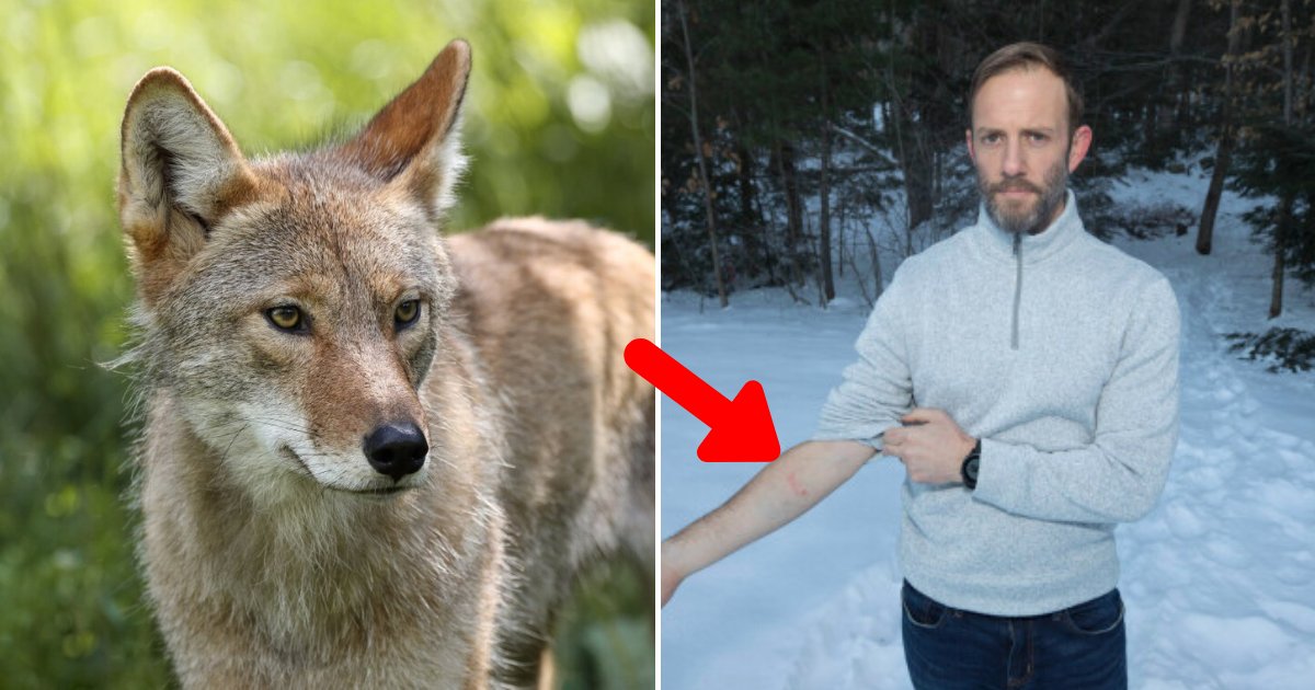 coyote6.png?resize=412,275 - Coyote Attacked A 2-Year-Old Boy, Hero Dad Went Into 'Protection Mode' And Strangled The Animal