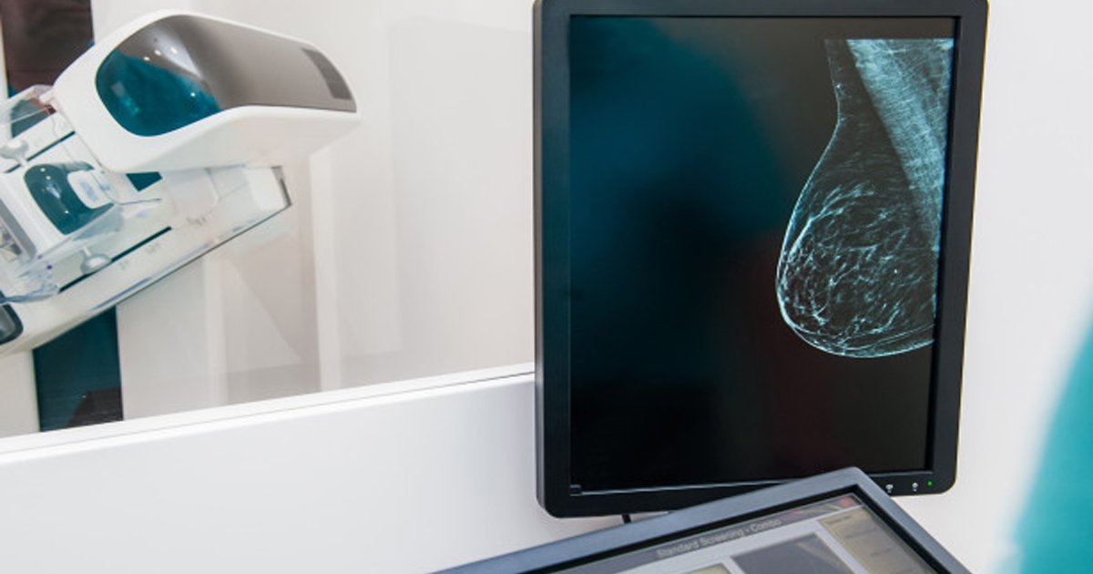 untitled 1 17.jpg?resize=412,275 - Google's AI Could Help Radiologists In Breast Cancer Screenings