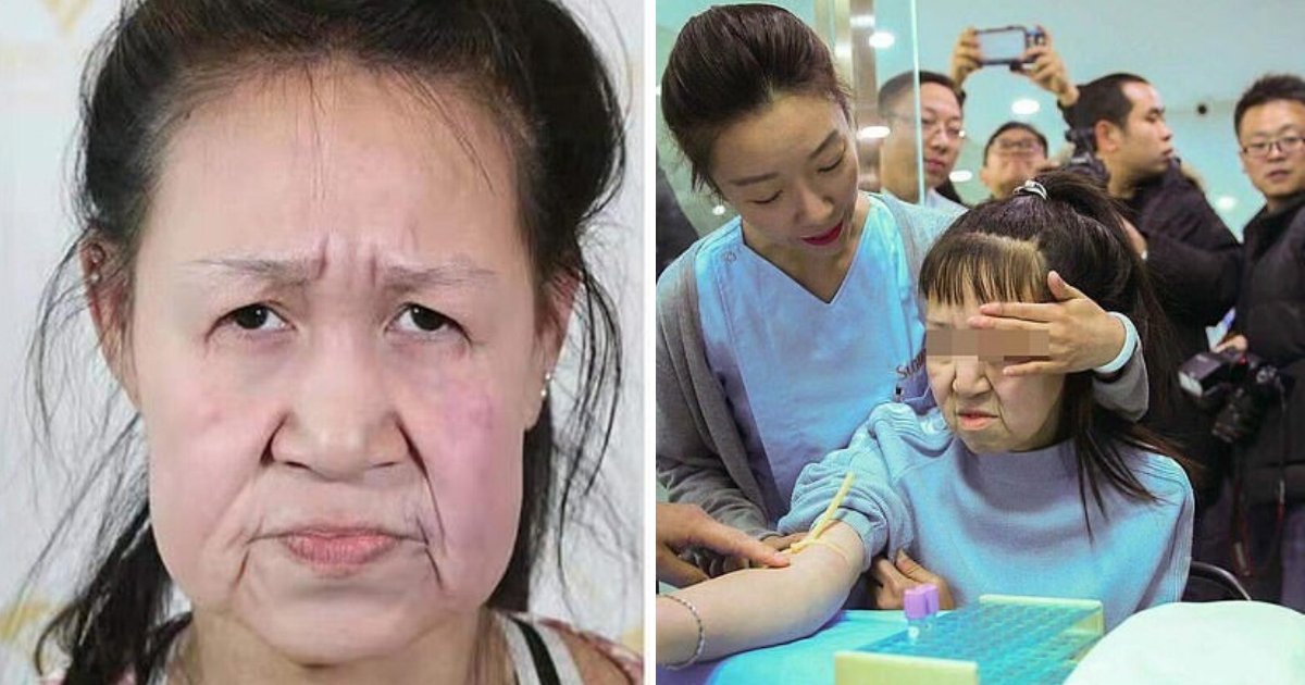 untitled design 7 2.png?resize=1200,630 - 15-Year-Old Girl Received A 'New' Face After Being Bullied For Looking Decades Older