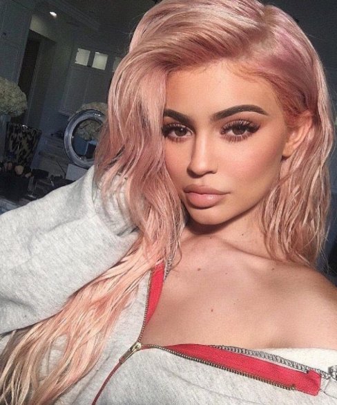  Kylie, pictured on Sunday, confirmed in 2016 that she had temporary lip fillers
