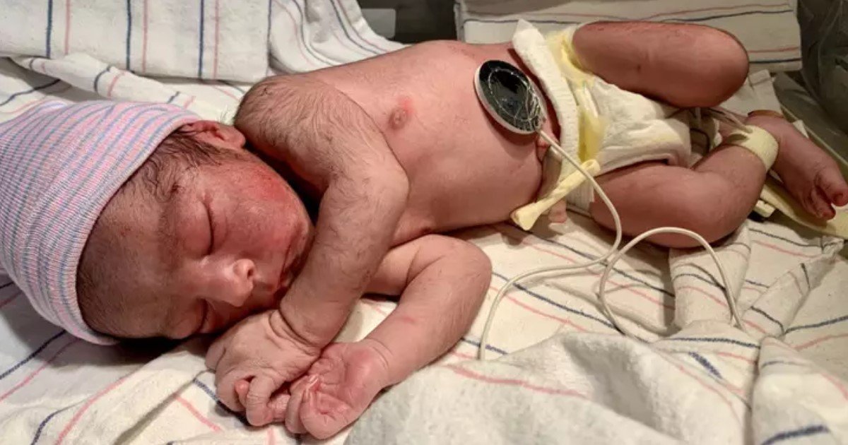 4 23.jpg?resize=412,232 - Baby Born With Unusual Body Hair Branded 'Mini Wolverine'