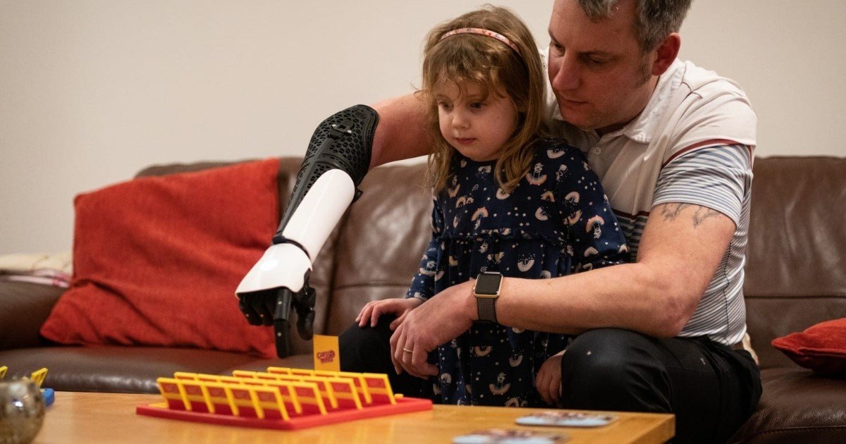 4 65.jpg?resize=1200,630 - A Veteran Who Lost His Right Forearm And Hand Got His 'Hero Arm,' A 3D Printed Bionic Arm