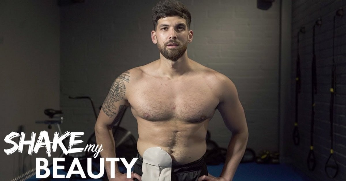b3 9.jpg?resize=412,275 - Personal Trainer "Proud" Of The Stoma Bag That Helped Him Beat The Odds And Survive
