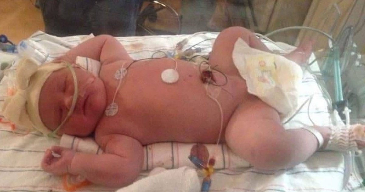 bebe 1.jpg?resize=1200,630 - Accouchement douloureux: Le record du bébé le plus lourd vient d'être battu !