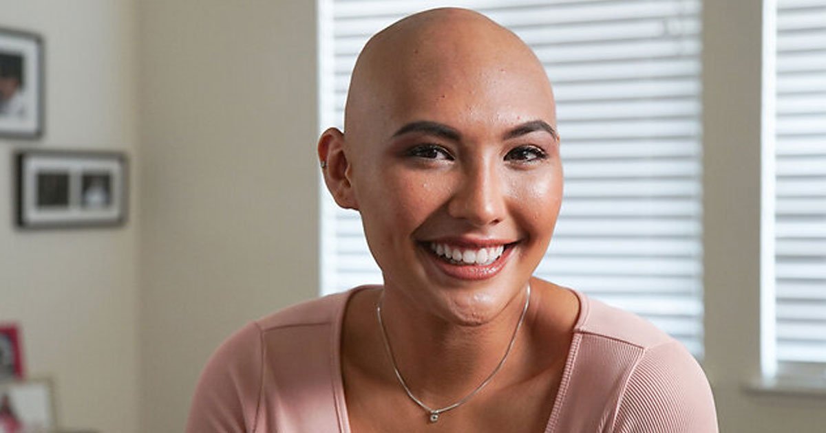 i am bald and sexy.jpg?resize=412,232 - 20-Year-Old Woman With Alopecia Totalis Hopes To Inspire People With Her Story