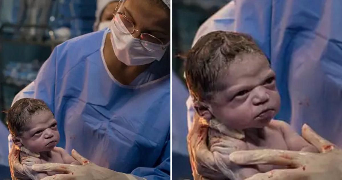 isabela4.png?resize=1200,630 - Moment hilarant: un nouveau-né fronce les sourcils à cause du docteur qui essaie de la faire pleurer