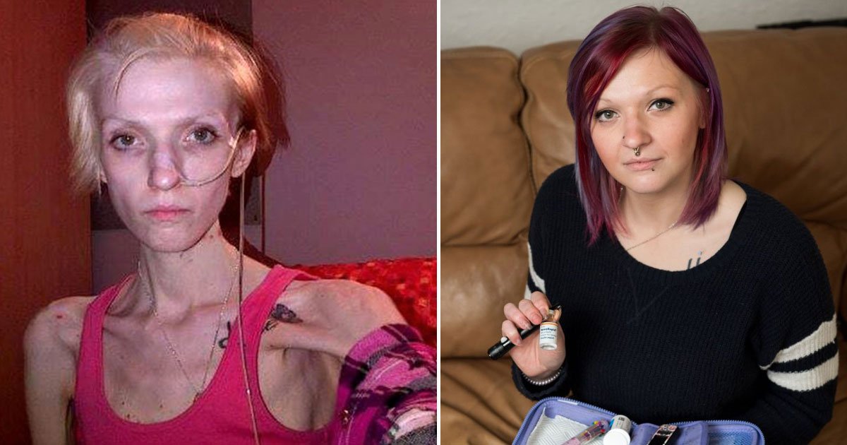 oman miraculous recovery eating disorder.jpg?resize=1200,630 - Diabetic Woman Made A Miraculous Recovery After Being Told She Would Not Survive