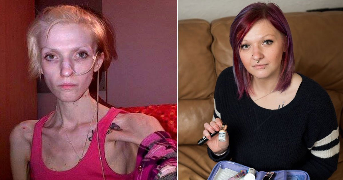 oman miraculous recovery eating disorder.jpg?resize=412,275 - Diabetic Woman Made A Miraculous Recovery After Being Told She Would Not Survive