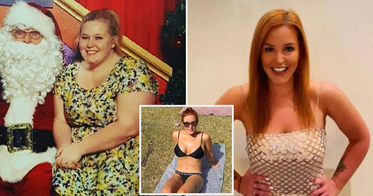 pcos8.png?resize=412,275 - Woman Lost 73 Kilograms After She Was Dumped By Her Boyfriend Because She Was 'Too Fat'