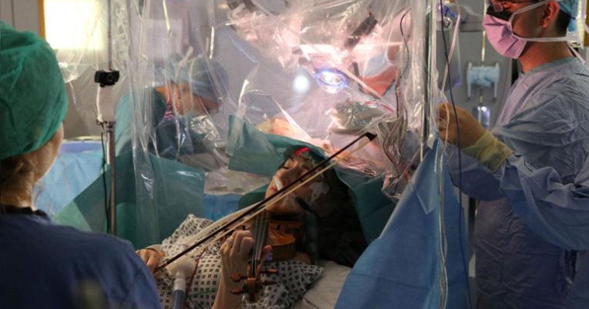 whatsapp image 2020 02 20 at 10 43 58 pm.jpeg?resize=412,275 - Half Woken Patient Plays Violin During Brain Surgery To Save Her Musical Skills