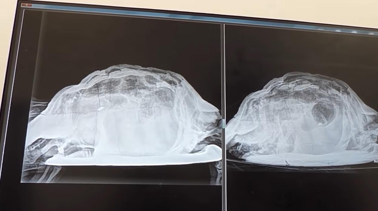 Resultado de imagen de mujer tenia tortuga en vagina