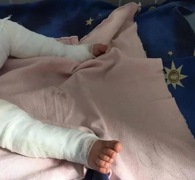 Murió un bebé luego de caer en una olla hirviendo | Vía País