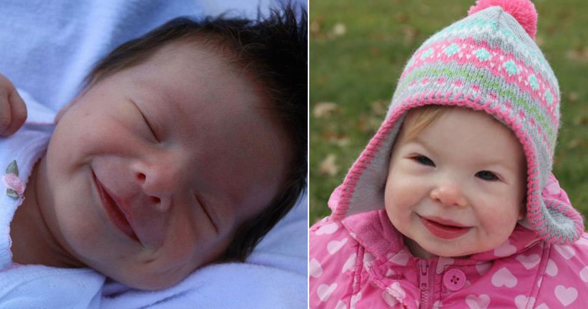 baby born with huge gron pinky fingers inwards.jpg?resize=1200,630 - Mother Noticed Her Baby Was Born With A Huge Grin But Doctors Told She Was Being 'Ridiculous'