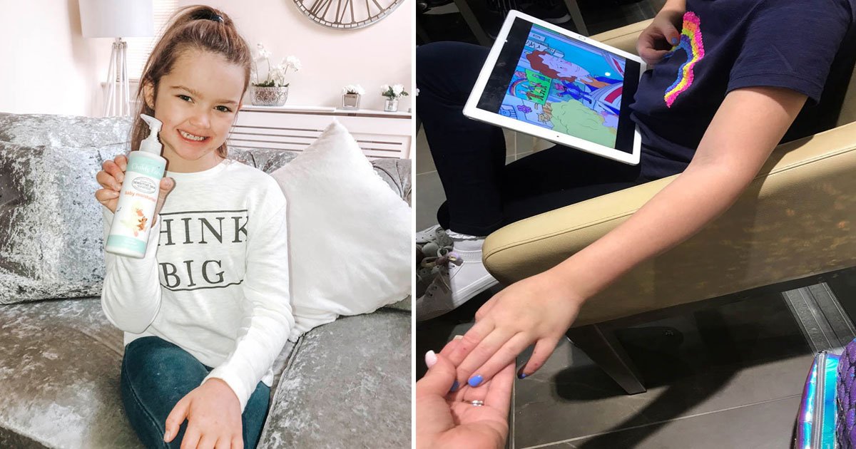 cream cured daughter eczema.jpg?resize=412,275 - Mother Revealed How A £4.50 Moisturizing Cream Cured Her Daughter’s Eczema After Spending Thousands Of Pounds And Suffering For Years