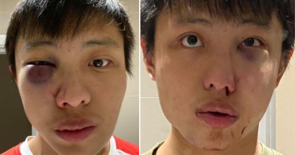 d3 1.png?resize=412,232 - Asian Student Was Beaten by a Mob in London Saying They Don't Want Coronavirus in Their Country