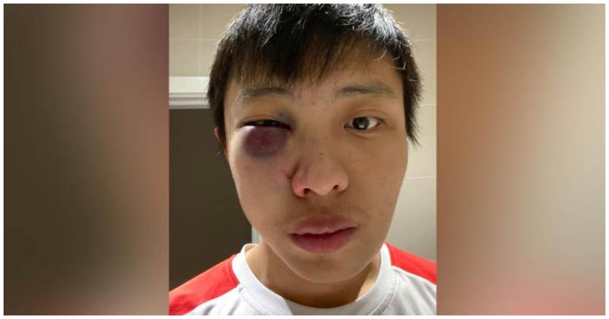 header asiatico.jpg?resize=412,275 - Estudiante Asiático Fue Atacado Por Grupo De Hombres Que "No quieren Enfermedades En Su País"
