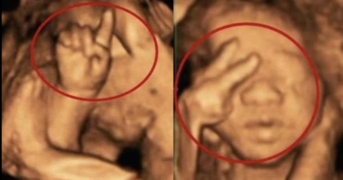 taiji.png?resize=1200,630 - 母体の中で胎児が指折り数えている？「天才児が産まれるのではないか」と医師も驚愕？