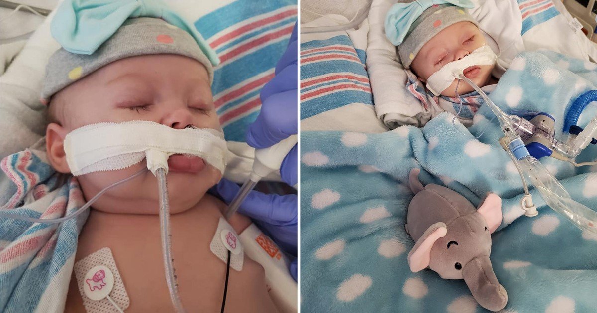 1 3.jpg?resize=412,232 - Madre Comparte Fotos De Su Hija De 2 Meses Hospitalizada Luego De Dar Positivo Por Contagio