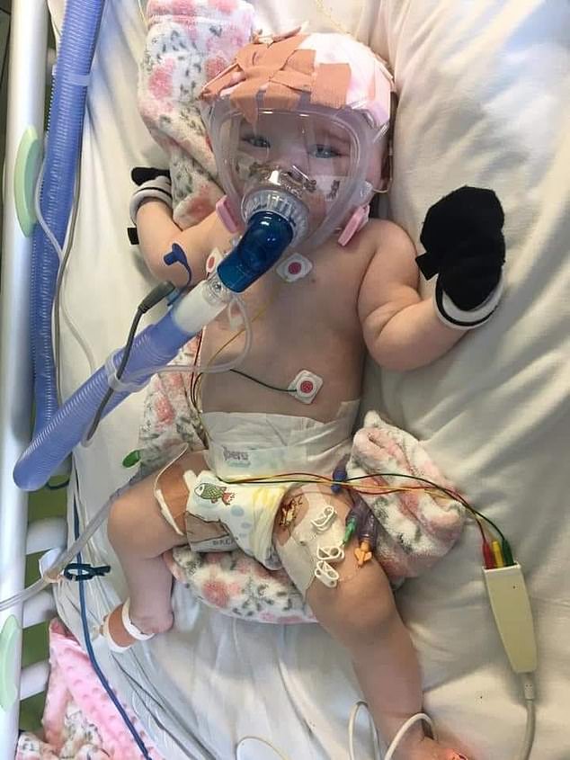 Six month-old Erin Bates linked up to a CPAP machine in Liverpool