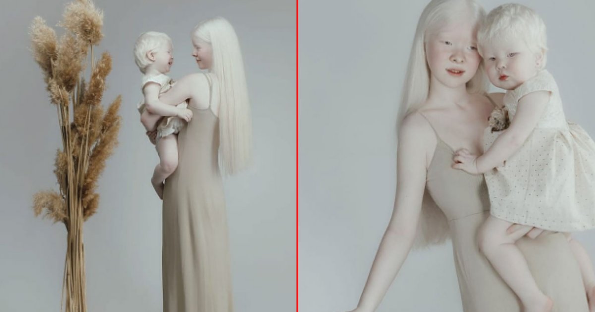4 64.png?resize=412,275 - Two Albino Sisters Who Are 12 Years Apart Are So Stunningly Beautiful