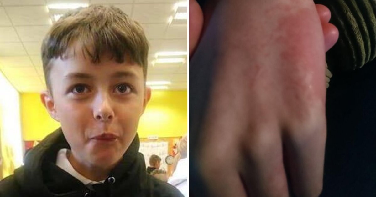 lewis6.png?resize=1200,630 - Young Boy Fighting For Life With COVID-19 After Developing Rashes And Red Eyes