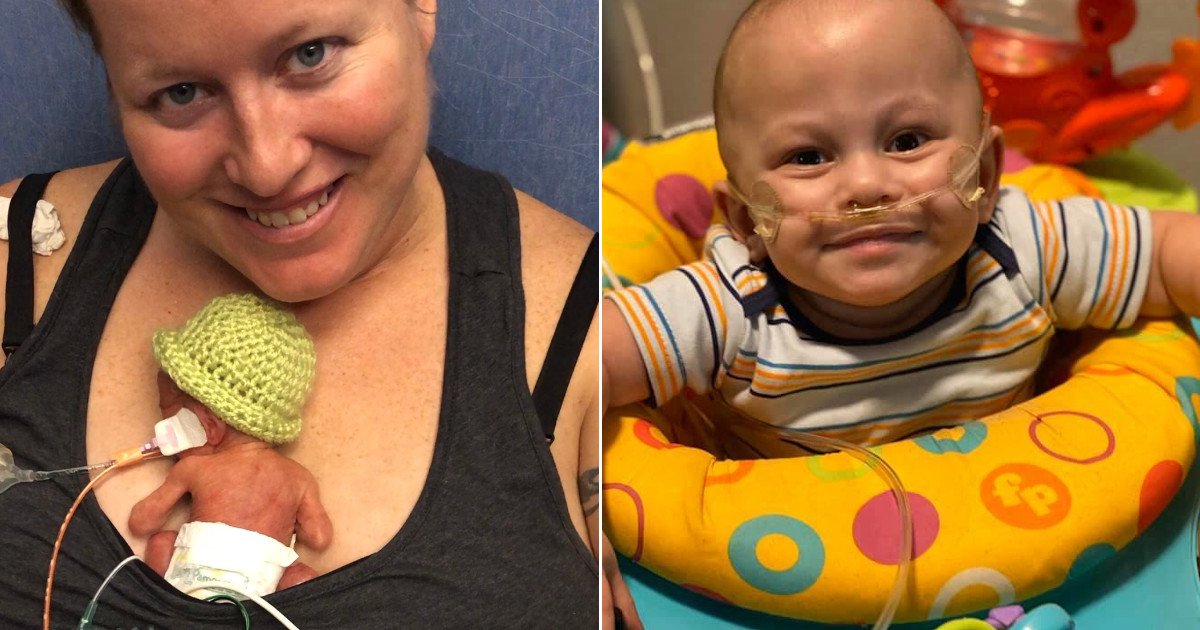 untitled 122.jpg?resize=412,275 - One-year-old With Less Than 10 Percent Chance Of Survival Is Thriving After Spending His First Eight Months In The Hospital
