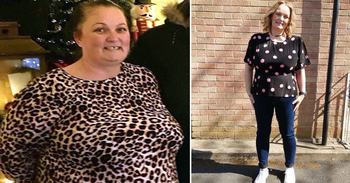 untitled 135.jpg?fit=1024%2C538&ssl=1&strip=all - Incredible Transformation Of A 20 Stone Woman Who Couldn’t Wash And Dress Herself And Was Told: “Diet Or Die”
