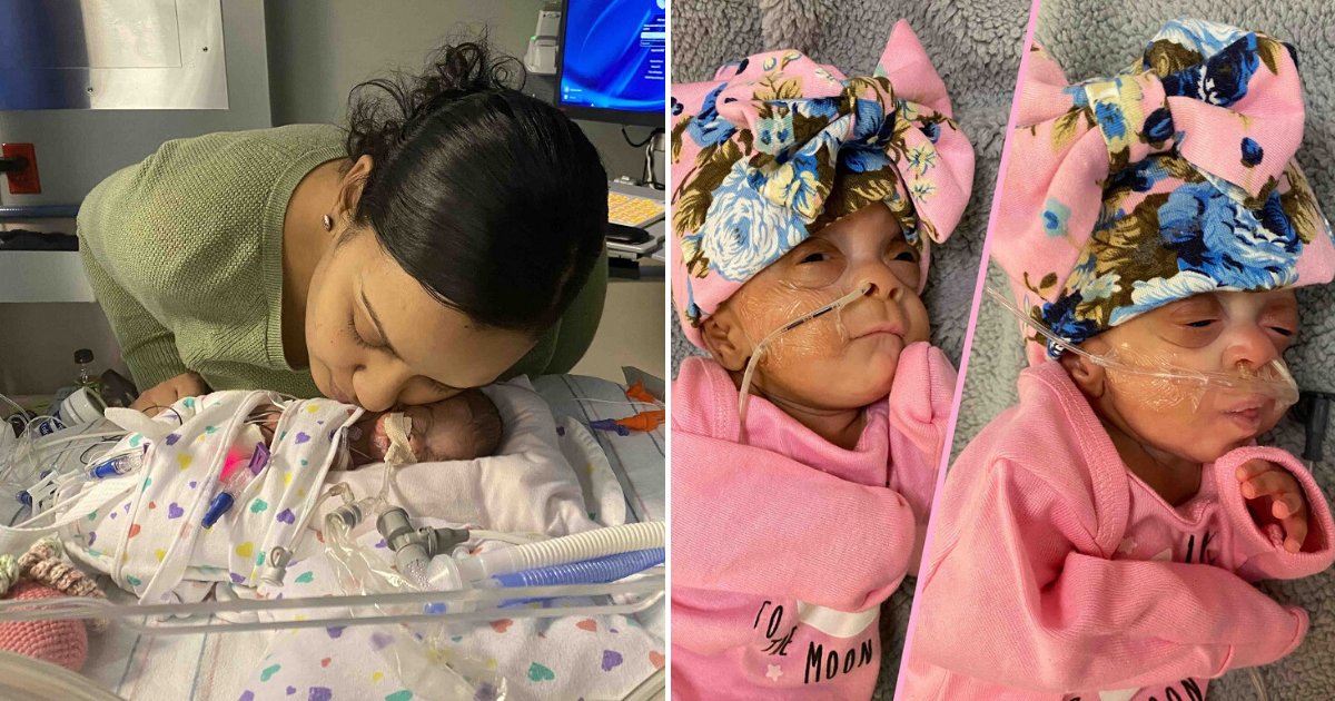 untitled design 15 3.png?resize=412,275 - Premature Twins Born At 22 Weeks Are Thriving Months After Their Birth