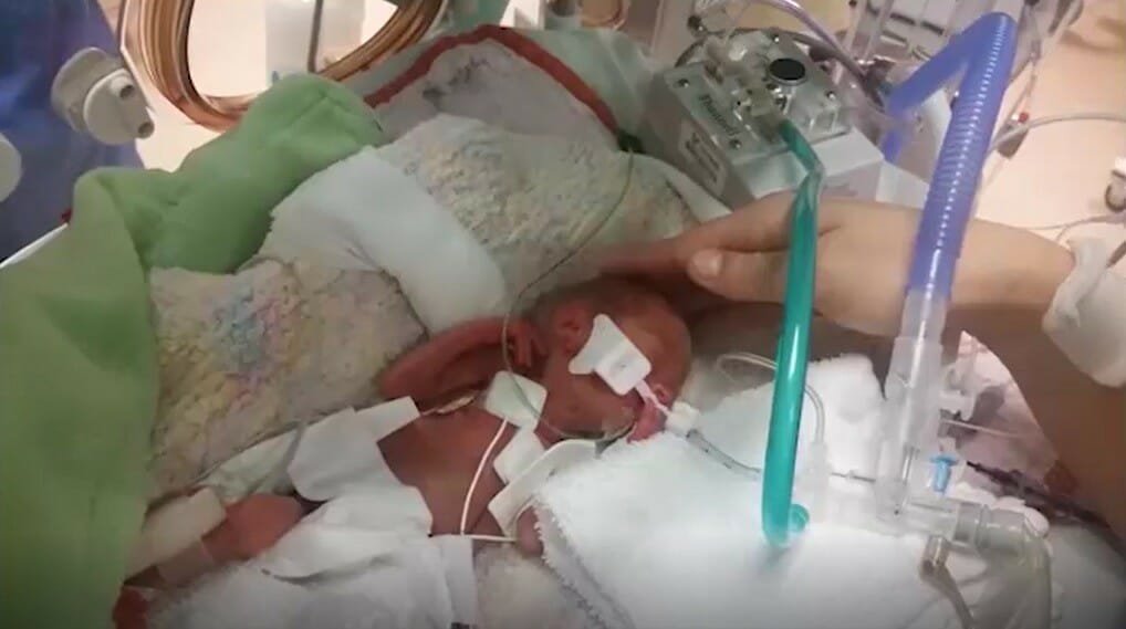 Baby girl born weighing 1 pound leaves hospital after 4 months