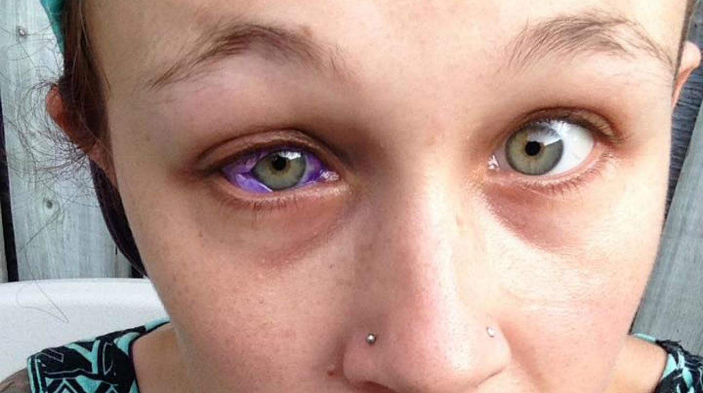 Un tatuaje ocular casi deja ciega a una modelo canadiense | TN
