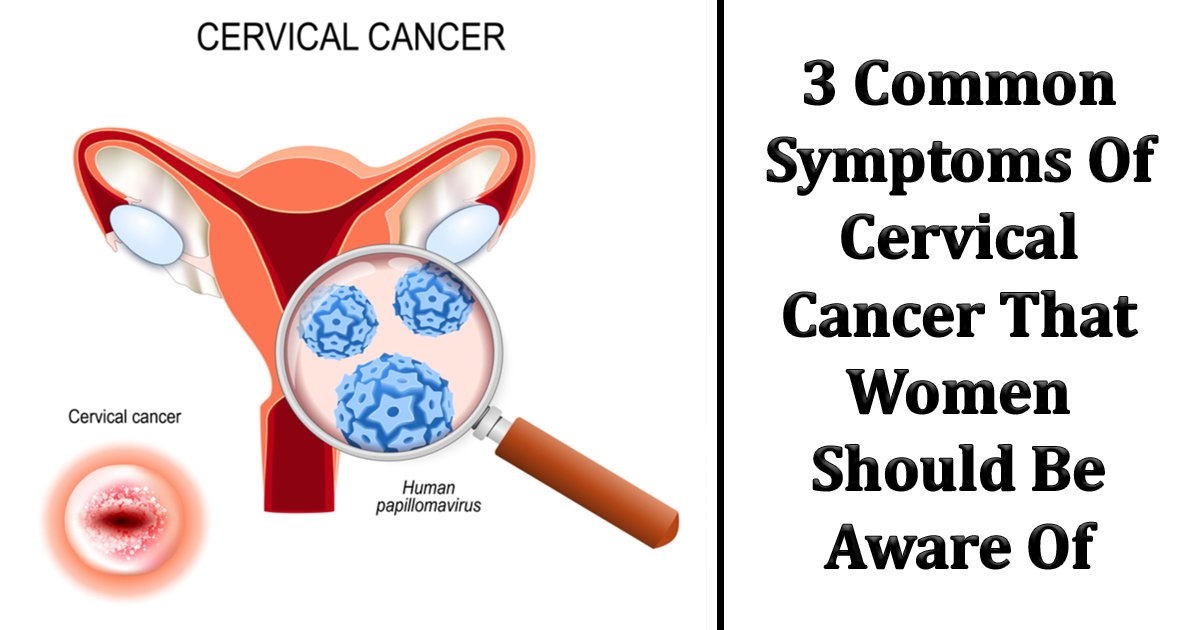 agggag.jpg?fit=1024%2C538&ssl=1&strip=all - Cervical Cancer Symptoms - How Uterine and Vaginal Differ