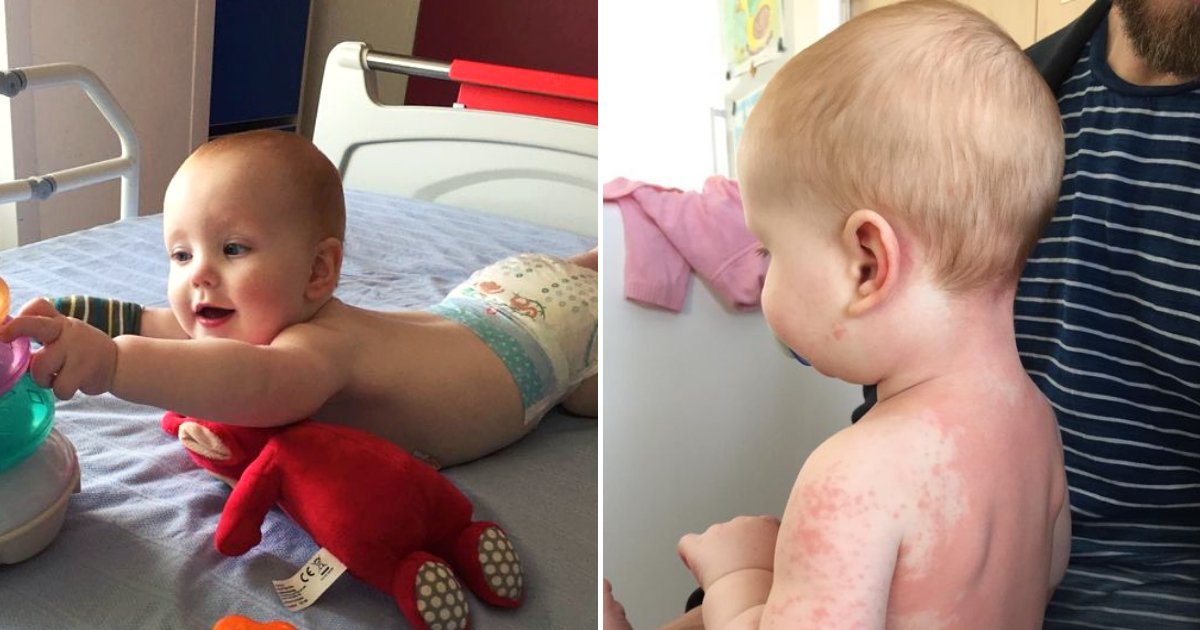 alex6.png?resize=412,275 - 8-Month-Old Baby Passed Away From Coronavirus-Linked Kawasaki Disease
