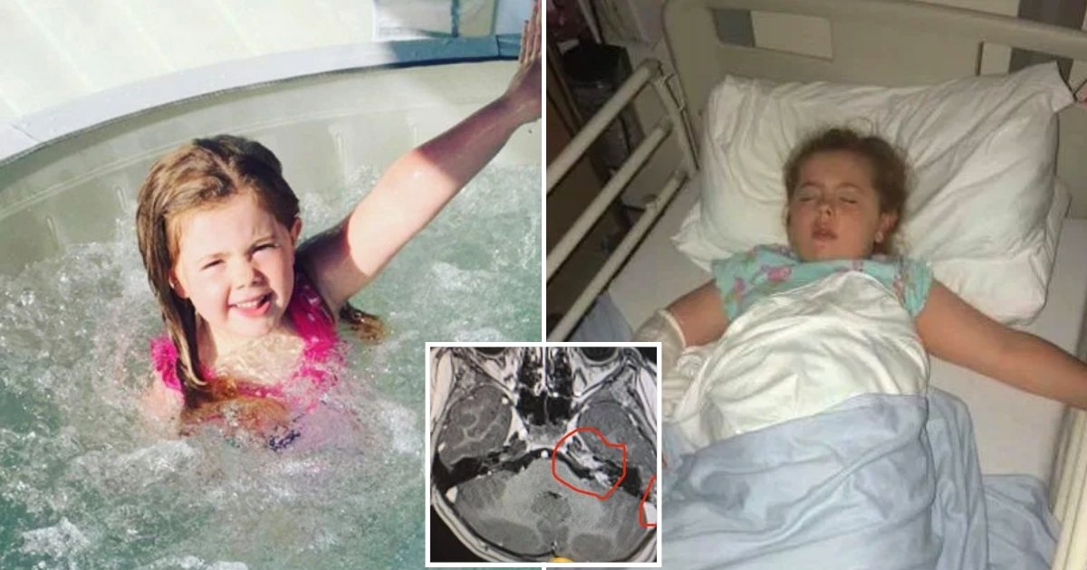 ameilia.png?resize=1200,630 - Mother Warns Other Parents After Life-Threatening Infection Entered Through 5-Year-Old Daughter's Ear And Spread To Her Brain
