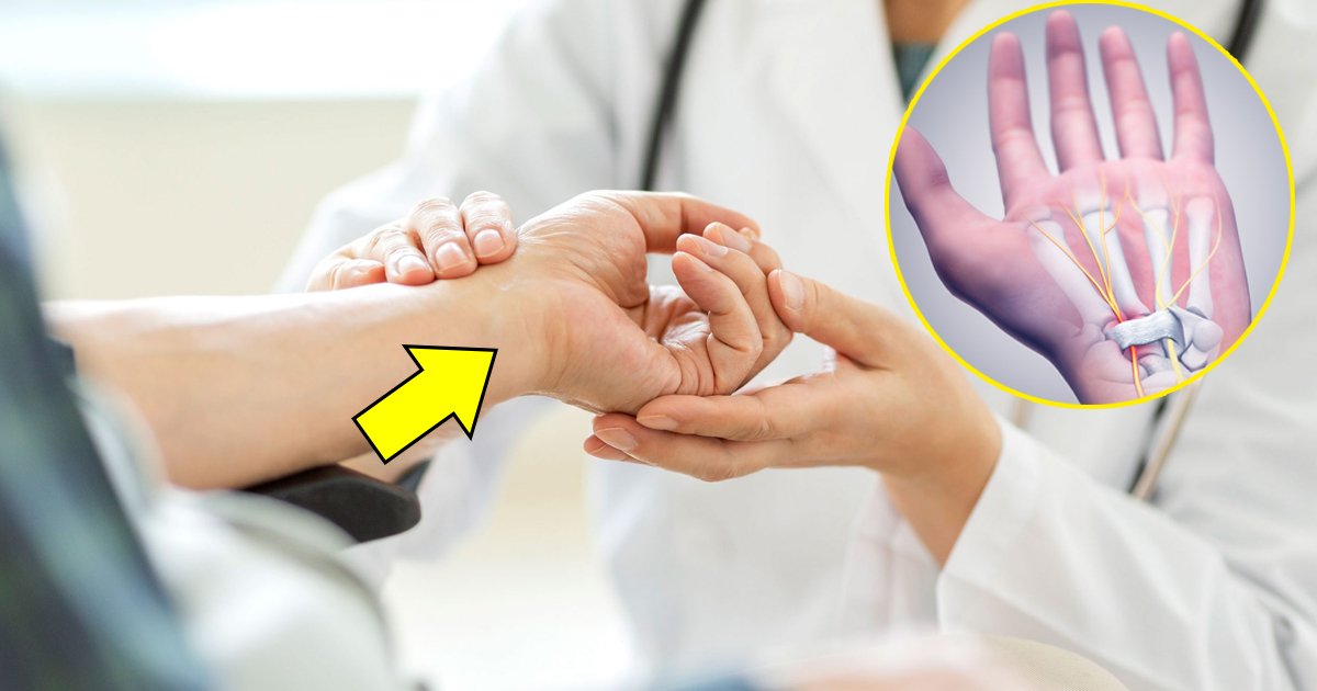 carpal tunnel syndrome.jpg?fit=1024%2C538&ssl=1&strip=all - Everything You Need to Know About Carpal Tunnel Syndrome