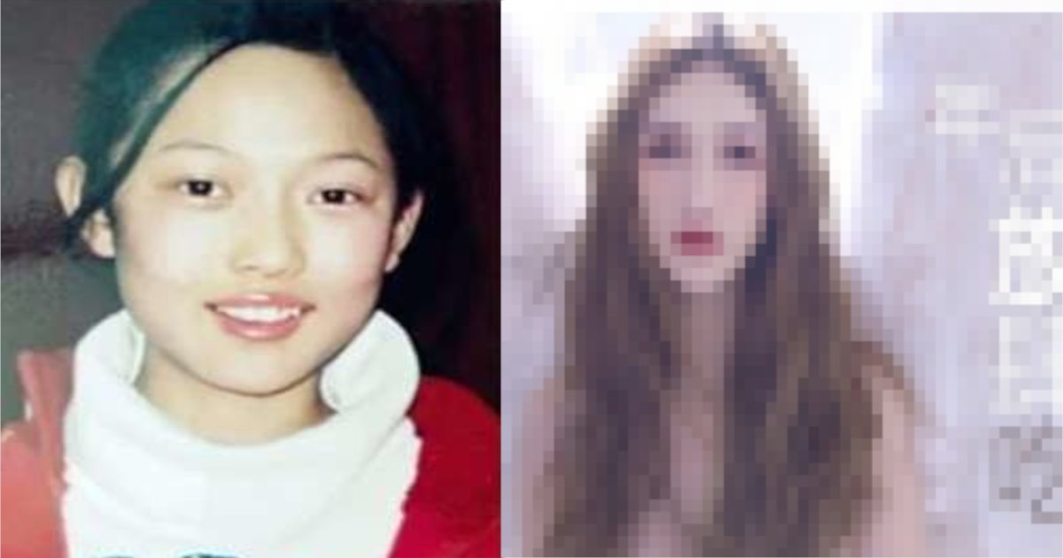 china.png?resize=412,275 - 14歳から○○回以上整形した30歳女性、美容整形外科のポスターに⁈　成功の陰には失敗も…