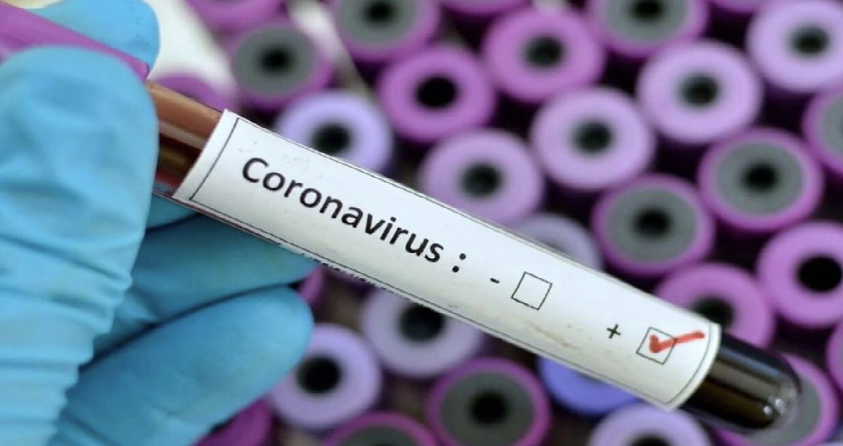 coronavirus.png?resize=412,275 - Des chercheurs auraient identifié une nouvelle souche du coronavirus encore plus contagieuse !