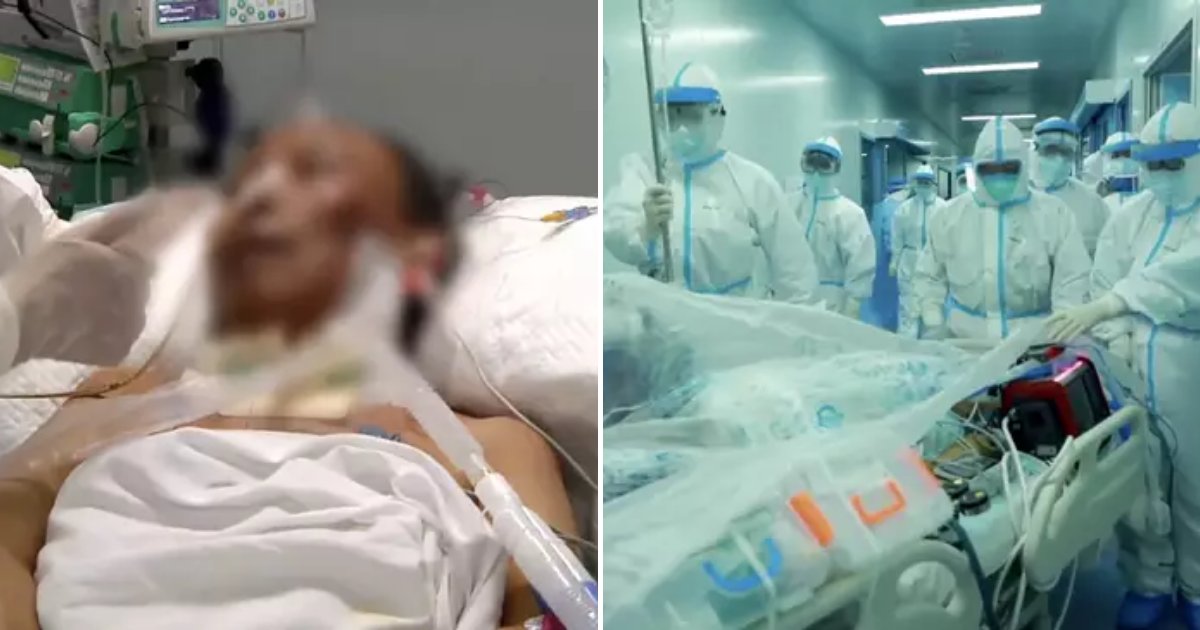 cui3.png?resize=1200,630 - 65-Year-Old Man On Life Support For 62 Days Recovers After 'Double' Lung Transplant