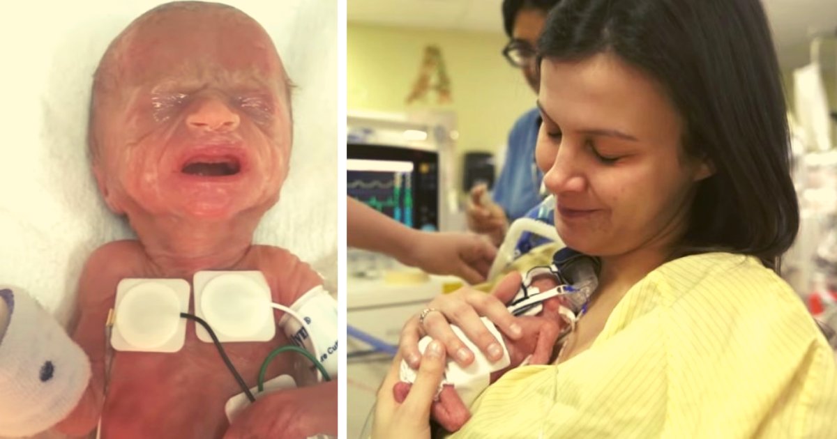 diseno sin titulo 74.png?resize=1200,630 - VIDEO: Bebé Nació Con 14 Semanas Y Pesaba Menos De 2 Kilos ¡Es Un Milagro!