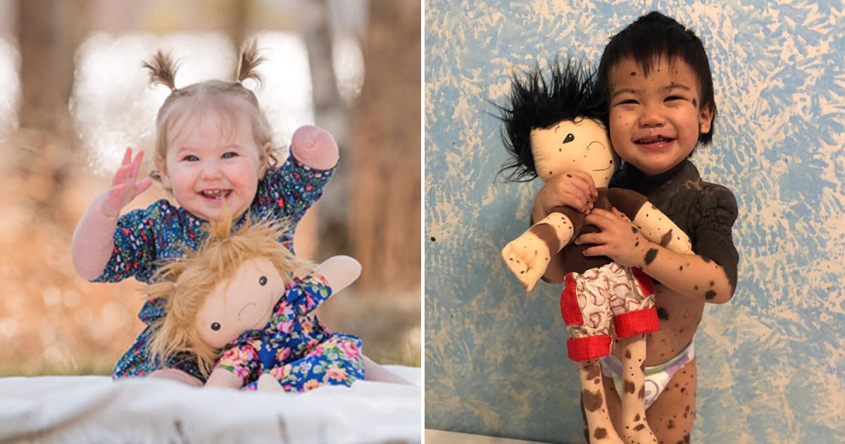 dolls12.png?resize=1200,630 - Woman Makes Look-Alike Dolls For Children With Disabilities To Make Them Feel Special