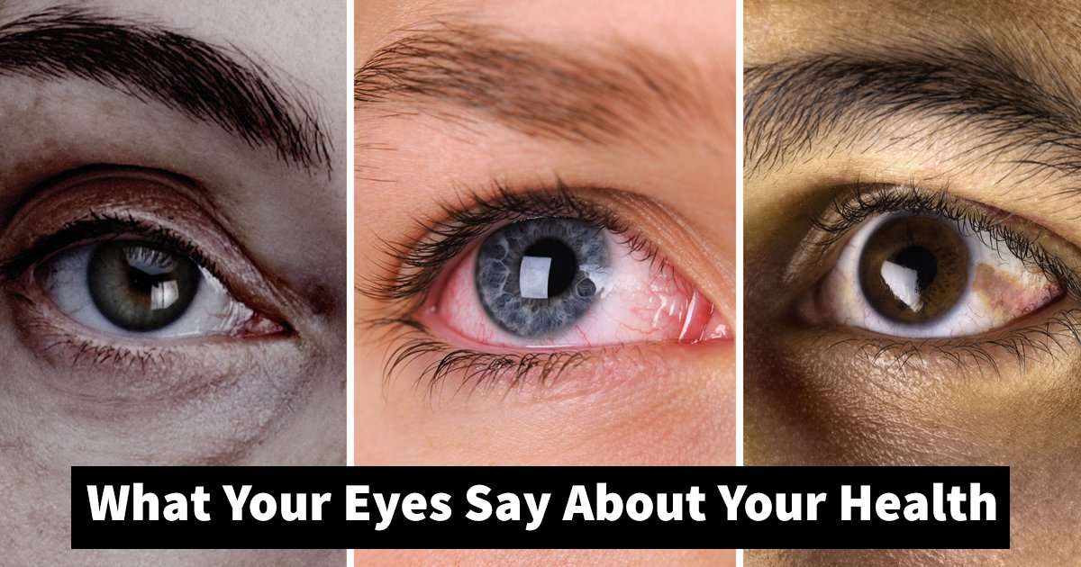 eyes about health.jpg?resize=412,275 - 7 Signs To Know What Your Eyes Say About Your Health