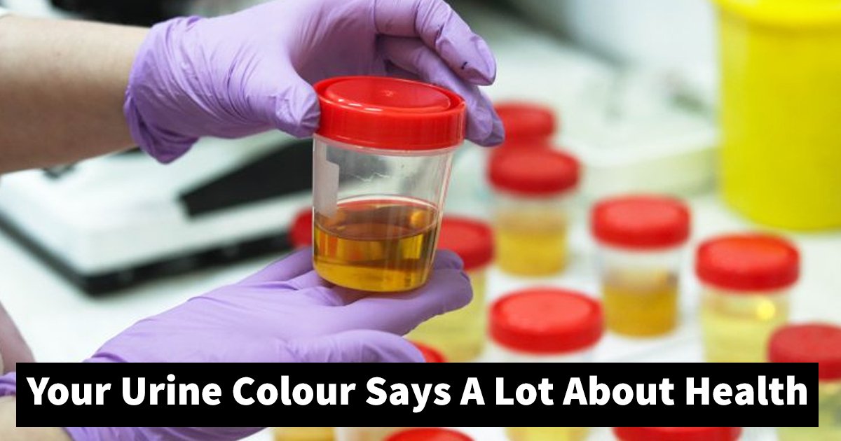 healthy urine color.jpg?fit=1024%2C538&ssl=1&strip=all - Here Is How You Can Find Out If You Have A Healthy Urine Color