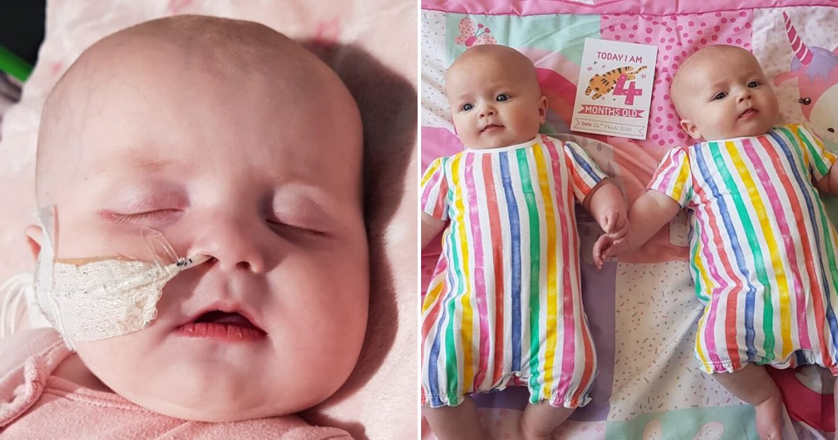 leiah5.png?resize=412,275 - Baby Develops Life-Threatening Inflammatory Illness While 'Twin Sister Escapes Unscathed'
