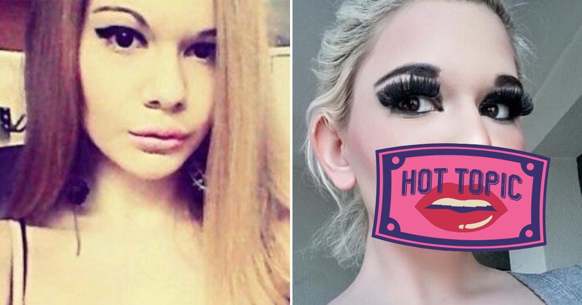 lips7.png?resize=412,232 - 22-Year-Old Woman Shared Photos Of Her ‘Fashionable’ Lips After 20TH Lip Injection