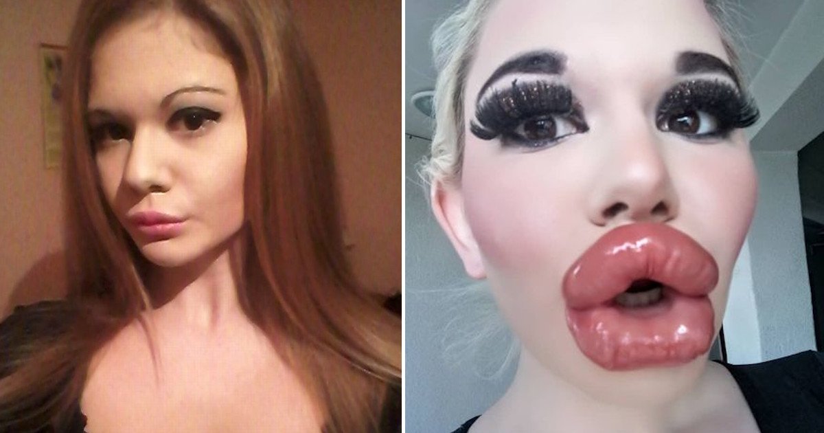 untitled 31.jpg?resize=1200,630 - Real-life Barbie Had Her 20th Lip Injection But Still Wants Her Lips Bigger