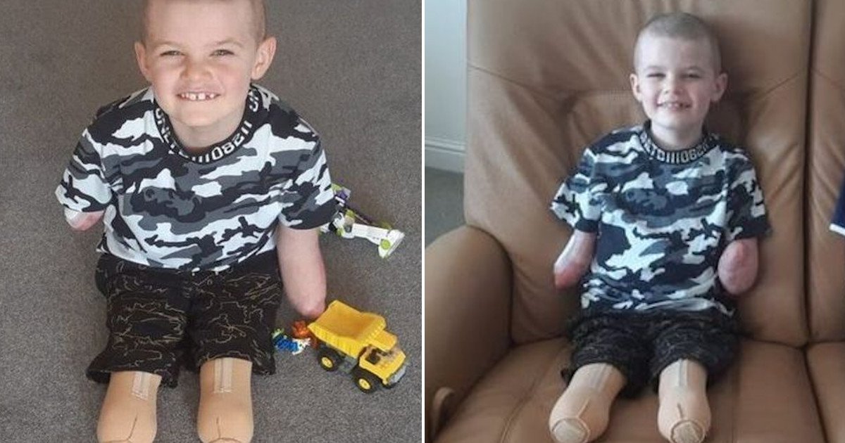 untitled 72.jpg?resize=412,275 - Seven-year-old Boy Lost All Four Limbs And Underwent 23 Operations After Contracting Meningitis