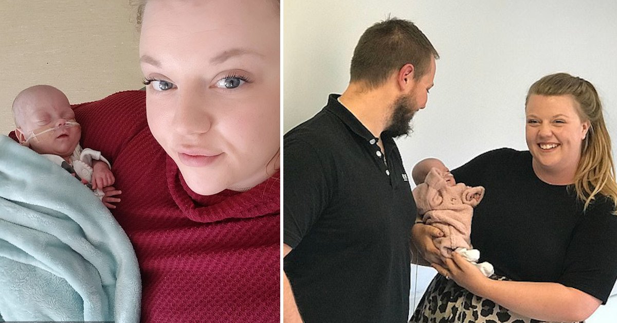 untitled 75.jpg?resize=412,275 - Baby Who Was Born At 22 Weeks And Fought Life-threatening Problems Is Finally Allowed To Go Home