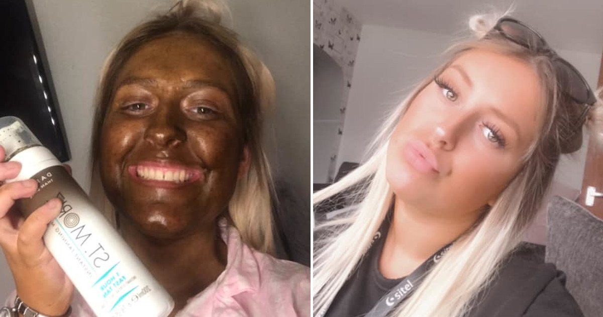 untitled 84.jpg?resize=1200,630 - NHS Worker Turned Dark Brown After Using £13 Fake Tan