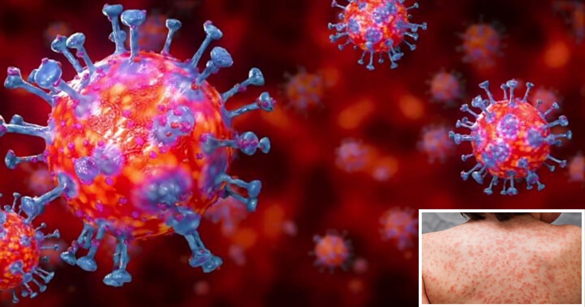untitled design 1 16.png?resize=412,275 - Boy With No Underlying Health Conditions Dies In The U.K. From Kawasaki-Like Illness Linked To Coronavirus